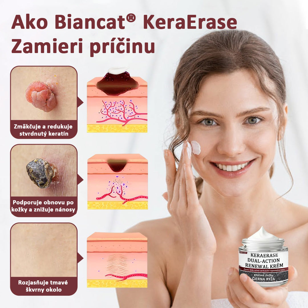 Biancat®KeraErase regeneračný krém s dvojitým účinkom